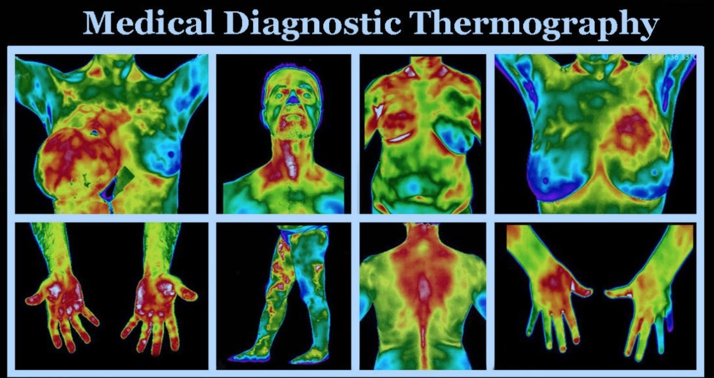 thermography2