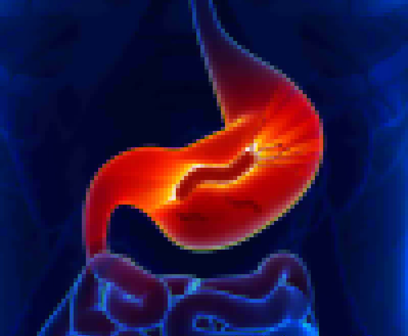 gastroesophageal-reflux-disease